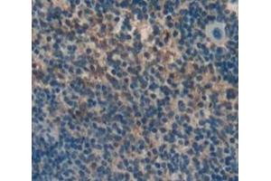 Figure. (CRLF1 antibody  (AA 110-408))