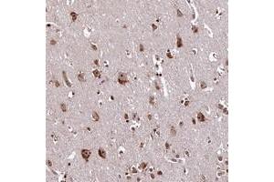 Immunohistochemical staining of human cerebral cortex with PDS5B polyclonal antibody  at 1:200-1:500 dilution.