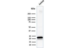 Western Blot Analysis of human Jurkat cell lysate using CD3e Mouse Monoclonal Antibody (C3e/1931). (CD3 epsilon antibody  (AA 23-119))