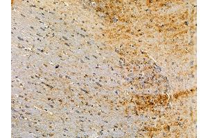 ABIN7095021 and ABIN7099077 at 1/100 staining rat brain tissue by IHC-P.