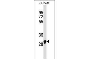 OR1N1 Antibody (C-term) (ABIN657733 and ABIN2846718) western blot analysis in Jurkat cell line lysates (35 μg/lane). (OR1N1 antibody  (C-Term))