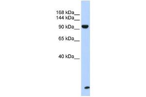 Western Blotting (WB) image for anti-Trinucleotide Repeat Containing 6B (TNRC6B) antibody (ABIN2458485)