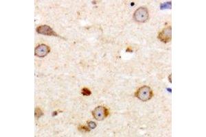 Immunohistochemical analysis of ME3 staining in human brain formalin fixed paraffin embedded tissue section. (ME3 antibody  (C-Term))