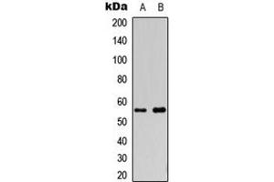Western blot analysis of Cytochrome P450 2S1 expression in HepG2 (A), COLO205 (B) whole cell lysates. (CYP2S1 antibody  (Center))