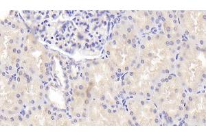 Detection of ENDOG in Human Kidney Tissue using Polyclonal Antibody to Endonuclease G, Mitochondrial (ENDOG) (Endonuclease G antibody  (AA 16-290))