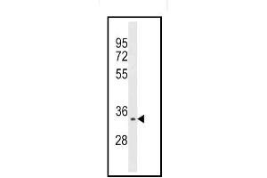 Western blot analysis of Aurora kinase C Antibody (C-term) Cat. (Aurora Kinase C antibody  (N-Term))