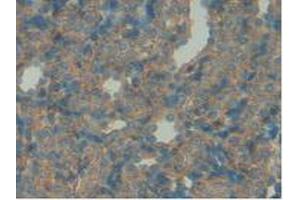 Detection of IGFBP7 in Rat Spleen Tissue using Polyclonal Antibody to Insulin Like Growth Factor Binding Protein 7 (IGFBP7) (IGFBP7 antibody  (AA 88-281))