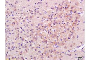 Formalin-fixed and paraffin embedded rat brain labeled with Rabbit Anti H Cadherin/T cadherin Polyclonal Antibody, Unconjugated (ABIN715271) at 1:200 followed by conjugation to the secondary antibody and DAB staining (Cadherin 13 antibody  (AA 301-400))