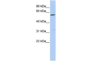 WB Suggested Anti-CEACAM16 Antibody Titration:  0. (CEACAM16 antibody  (Middle Region))