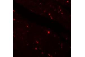 Immunofluorescence of KLOTOH in mouse heart tissue with KLOTHO antibody at 20 ug/ml. (Klotho antibody  (Center))