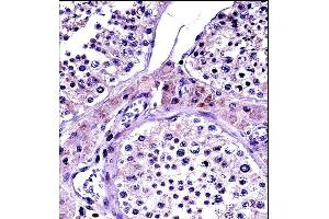 NR0B1 Antibody (Center) (ABIN657696 and ABIN2846687) immunohistochemistry analysis in formalin fixed and paraffin embedded human testis tissue followed by peroxidase conjugation of the secondary antibody and DAB staining. (NR0B1 antibody  (AA 304-333))