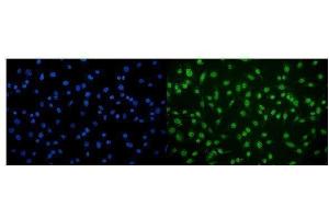 IF analysis of CAMKIV/Camk4 using anti-CAMKIV/Camk4 antibody (ABIN7600419). (CAMK4 antibody  (AA 19-469))