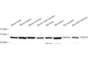 Western blot analysis of VMAT1 (ABIN7075654) at dilution of 1: 1000 (SLC18A1 antibody)