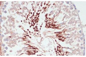 Immunohistochemistry of paraffin-embedded Rat testis using PGK2 Polyclonal Antibody at dilution of 1:100 (40x lens). (PGK2 antibody)