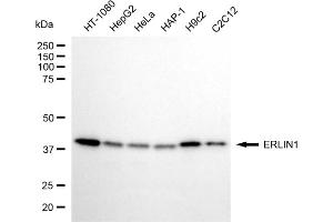 anti-ER Lipid Raft Associated 1 (ERLIN1) antibody