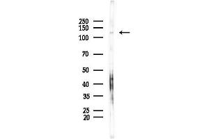 anti-PAX Interacting (With Transcription-Activation Domain) Protein 1 (PAXIP1) antibody