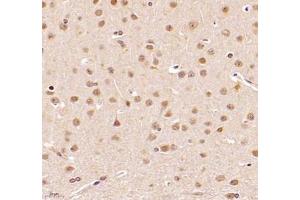 Immunohistochemistry of paraffin embedded rat brain using DDX19B (ABIN7073694) at dilution of 1: 1000 (400x lens)
