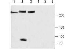 Western blot analysis of rat brain (lanes 1 and 4), mouse heart (lanes 2 and 5) and SH-SYS5 cell (lanes 3 and 6) lysates: - 1-3. (NALCN antibody  (Domain 3, Extracellular))