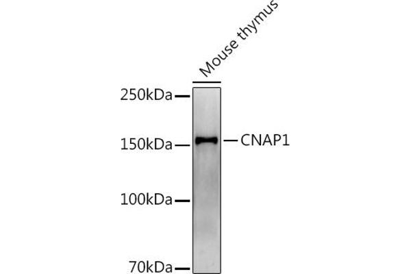 NCAPD2 antibody