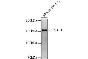 Western blot analysis of extracts of Mouse thymus, using (ABIN7268948) at 1:1000 dilution. (NCAPD2 antibody)