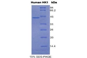 SDS-PAGE (SDS) image for Hexokinase 1 (HK1) (AA 413-540) protein (His tag,GST tag) (ABIN1525445) (Hexokinase 1 Protein (HK1) (AA 413-540) (His tag,GST tag))