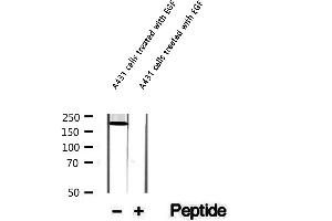 Western blot analysis of extracts of A431 cells treated with EGF, using Phospho-Afadin (Ser1799) Antibody. (Afadin antibody  (pSer1799))