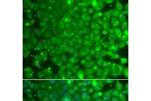 Immunofluorescence analysis of A549 cells using KBTBD7 Polyclonal Antibody (KBTBD7 antibody)