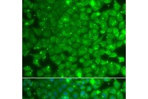 Immunofluorescence analysis of A549 cells using KBTBD7 Polyclonal Antibody