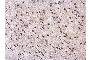IHC-P Image MPP3 antibody [N1C1] detects MPP3 protein at cytoplasm and nucleus in mouse brain by immunohistochemical analysis. (MPP3 antibody  (Center))