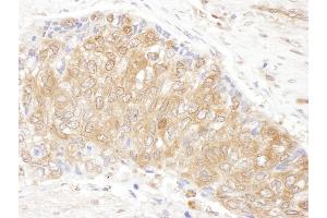 anti-Chaperonin Containing TCP1, Subunit 3 (Gamma) (CCT3) (AA 495-545) antibody