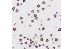 Immunohistochemical analysis of PRDM14 staining in human kidney formalin fixed paraffin embedded tissue section. (PRDM14 antibody)