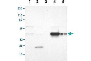 Western Blot analysis of Lane 1: RT-4, Lane 2: U-251MG sp, Lane 3: human plasma (IgG/HSA depleted), Lane 4: human liver and Lane 5: human tonsil lysates with FAM50A polyclonal antibody . (FAM50A antibody)