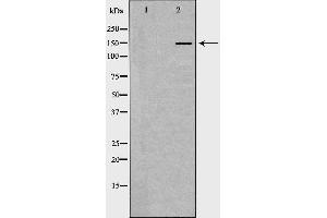 Western blot analysis of extracts of liver , using INSR antibody.