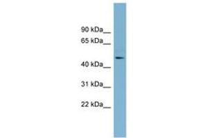 Image no. 1 for anti-Trimethyllysine Hydroxylase, epsilon (TMLHE) (AA 323-372) antibody (ABIN6742153) (TMLHE antibody  (AA 323-372))