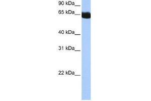 WB Suggested Anti-NSUN6 Antibody Titration:  0.