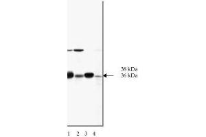 Image no. 1 for anti-SNAP alpha/beta antibody (ABIN364556) (SNAP alpha/beta antibody)