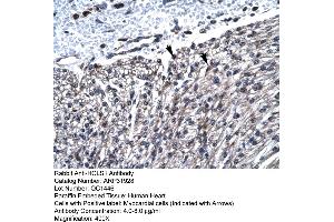 Immunohistochemistry (IHC) image for anti-Hematopoietic Cell-Specific Lyn Substrate 1 (HCLS1) (N-Term) antibody (ABIN2777503)
