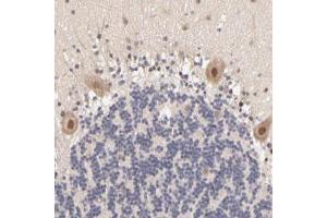 Immunohistochemical staining (Formalin-fixed paraffin-embedded sections) of human cerebellum with TXNL1 polyclonal antibody  shows moderate nuclear positivity in Purkinje cells. (TXNL1 antibody)