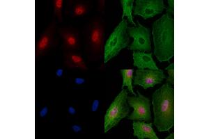 ABIN6257687 and ABIN6274287 staining  cells by IF/ICC. (CEBPG antibody  (Internal Region))