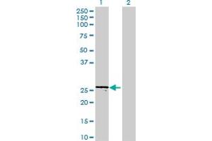 Western Blot analysis of FTSJ2 expression in transfected 293T cell line ( H00029960-T01 ) by FTSJ2 MaxPab polyclonal antibody. (FTSJ2 antibody  (AA 1-246))