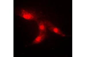 Immunofluorescent analysis of CRABP2 staining in HeLa cells. (CRABP2 antibody  (Center))