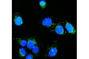 IF analysis of Hexokinase 1/HK1 using anti-Hexokinase 1/HK1 antibody (ABIN7600258).