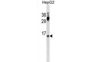 CYYR1 Antibody (C-term) (ABIN1881247 and ABIN2838999) western blot analysis in HepG2 cell line lysates (35 μg/lane). (CYYR1 antibody  (C-Term))