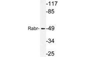 Western blot (WB) analysis of Rabr antibody in extracts from MCF-7cells.