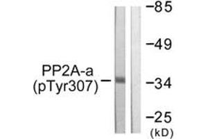 Western Blotting (WB) image for anti-Protein Phosphatase 2, Catalytic Subunit, alpha Isozyme (PPP2CA) (AA 260-309), (pTyr307) antibody (ABIN1531377)