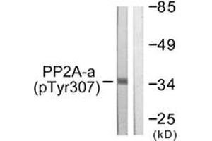 Western blot analysis of extracts from A549 cells, using PP2A-alpha (Phospho-Tyr307) Antibody. (PPP2CA antibody  (pTyr307))