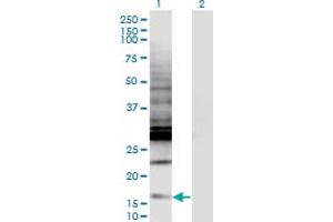 Western Blot analysis of CREBL2 expression in transfected 293T cell line by CREBL2 monoclonal antibody (M04), clone 1C1. (CREBL2 antibody  (AA 1-120))