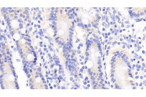 Detection of TRAF1 in Human Small intestine Tissue using Polyclonal Antibody to TNF Receptor Associated Factor 1 (TRAF1) (TRAF1 antibody  (AA 131-381))