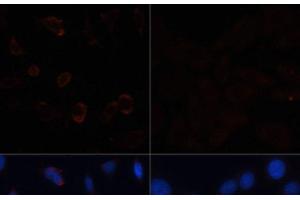 Immunofluorescence analysis of HeLa cells using ACACA Polyclonal Antibody at dilution of 1:100. (Acetyl-CoA Carboxylase alpha antibody)
