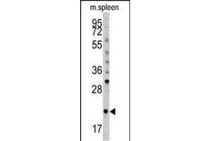 小鼠脾组织裂解物中抗小鼠BID抗体（S61）（ABIN388100和ABIN2846184）的Western blot分析（35⁄μg/lane）。（BID抗体（AA 39-68））